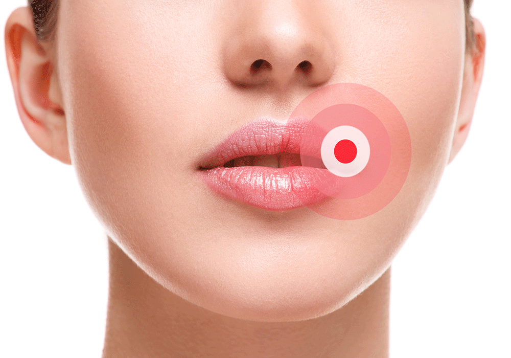 womens lips with target on them