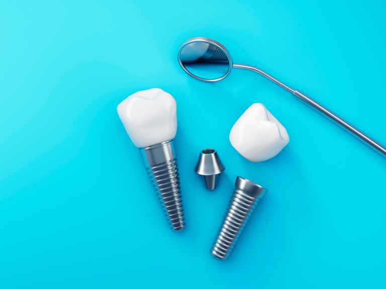 two dental implants on blue background