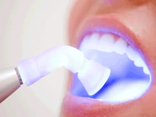 Soft-tissue laser dentistry available at Romeoville Dental Group in Romeoville, IL